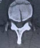 Figura 6