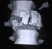 Figura 2