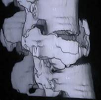 Figura 3