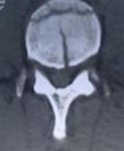 Figura 6