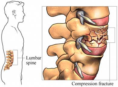 factsheet image