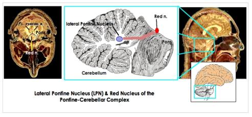 [Lateral Pontine Nucleus]
